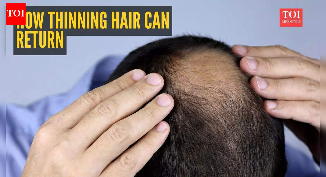 ‘Your hair can come back’: Doctor shares science-backed plan to restore thinning hair