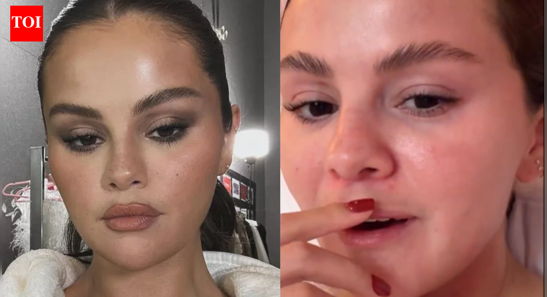 Selena Gomez opens up after facing comments about her ‘moustache’ on social media