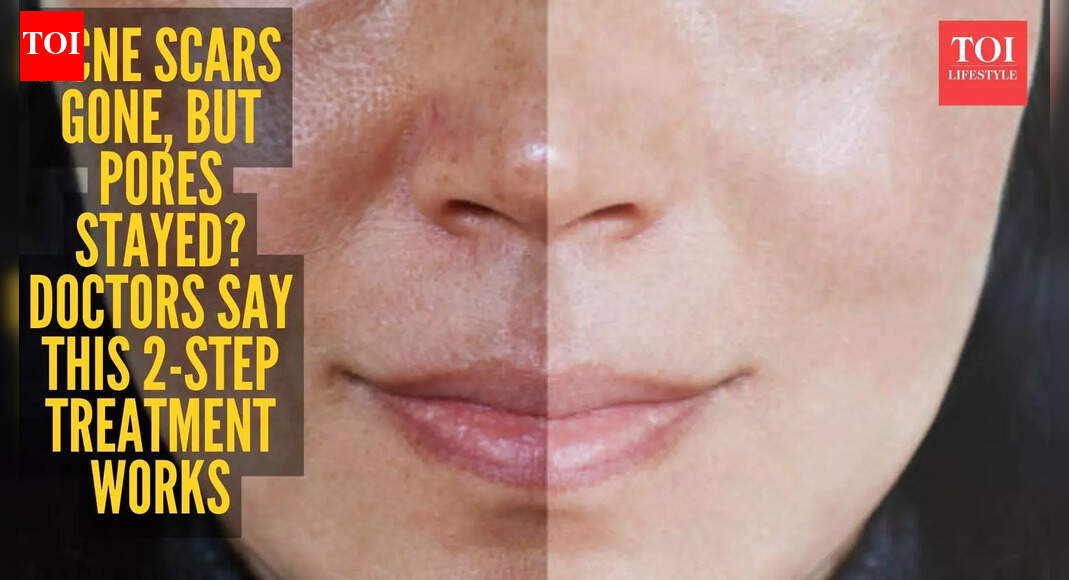 Tried everything for enlarged pores? This dermatologist-backed combo may be the answer