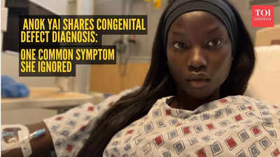 Supermodel Anok Yai reveals one common symptom she ignored before congenital defect diagnosis