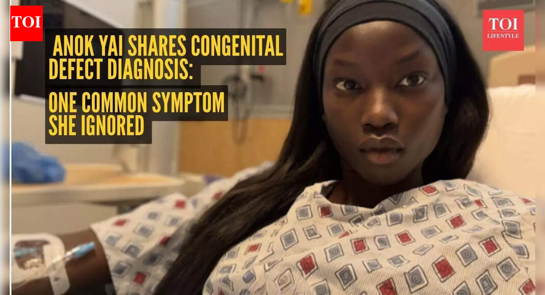 Supermodel Anok Yai reveals one common symptom she ignored before congenital defect diagnosis
