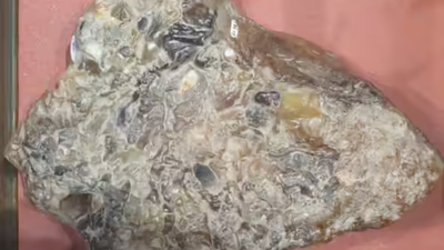 Gujarat man arrested with whale vomit worth Rs 80 lakh in Mumbai