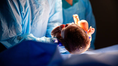 Are severe lung conditions in newborns always fatal? Doctors weigh in, debunk myths and share case studies