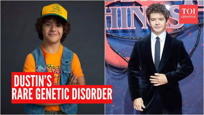 Stranger Things' Dustin Henderson's "toothless smile" is due to a rare condition: 10 facts to know about Cleidocranial Dysplasia