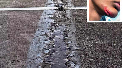 Broken track, debris cause injuries to school athletes