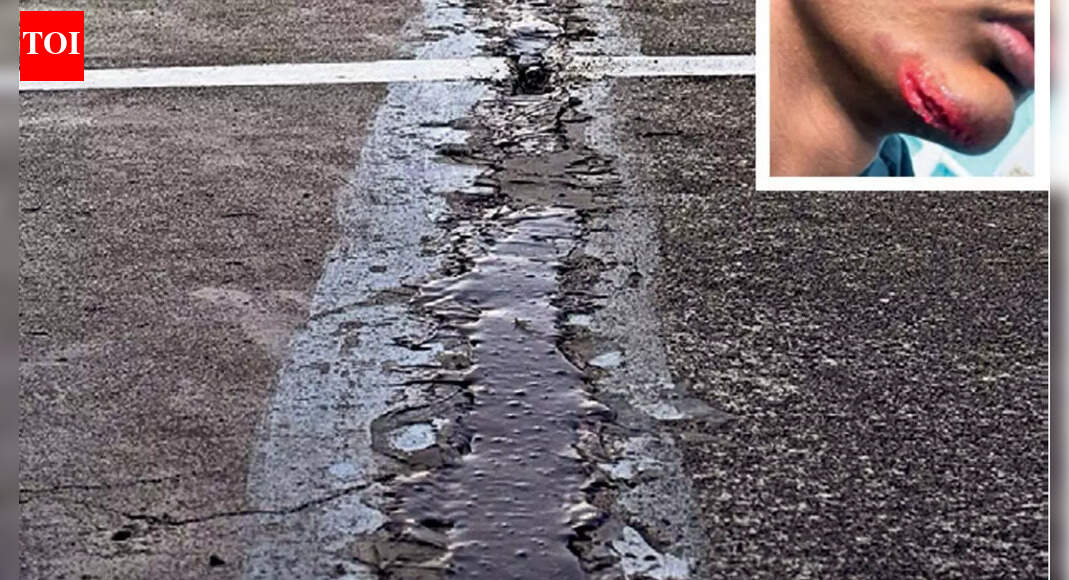 Broken track, debris cause injuries to school athletes