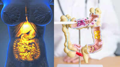 காஸ்ட்ரோபரேசிஸ் எதிராக எரிச்சல் கொண்ட குடல் நோய்க்குறி: அறிகுறிகள், சிகிச்சைகள் மற்றும் வேறுபாடுகள் விளக்கப்பட்டுள்ளன