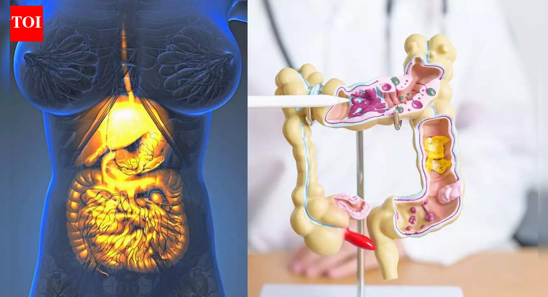 Gastroparesis vs irritable bowel syndrome: Key differences, symptoms and treatments