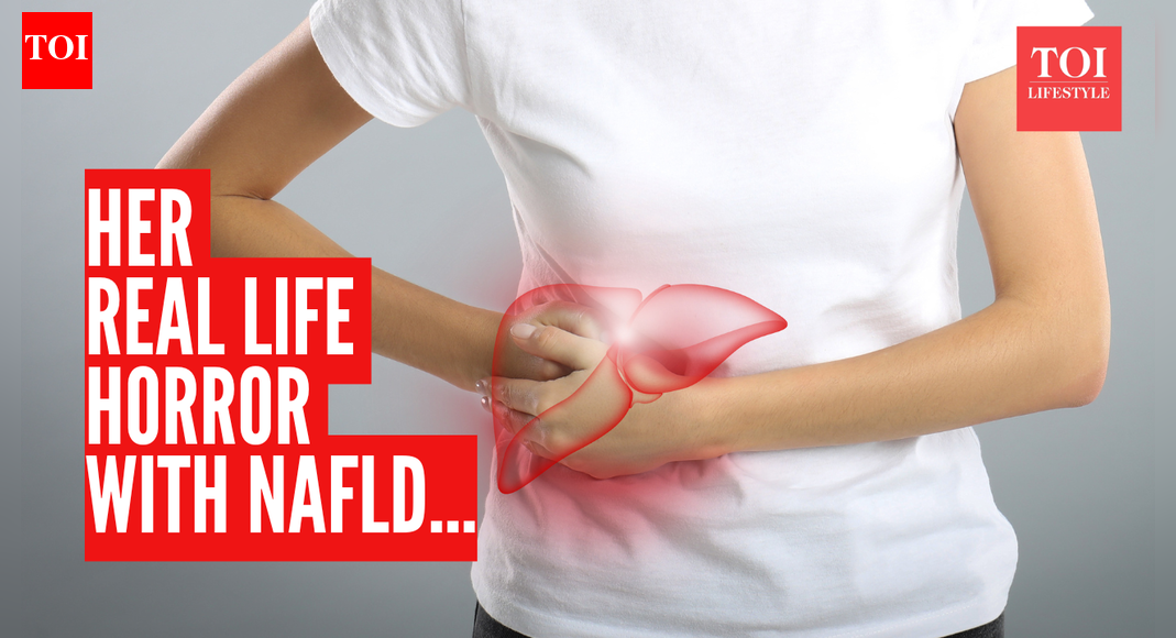 गंभीर गैर-अल्कोहल फैटी लीवर रोग: डॉक्टर ने वास्तविक कहानी साझा की कि कैसे एक महिला अपनी शादी से चूक गई और उसने किन लक्षणों को नजरअंदाज कर दिया