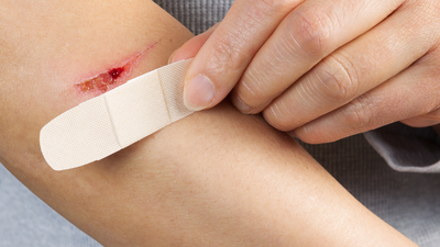 பொதுப் போக்குவரத்தில் ஒரு சிறிய, அறியப்படாத வெட்டு ஏன் புறக்கணிக்கப்படக்கூடாது என்று பெண் பகிர்ந்து கொள்கிறார்; பிளேடால் வெட்டப்பட்ட தனிப்பட்ட அனுபவத்தைப் பகிர்ந்து கொள்கிறது