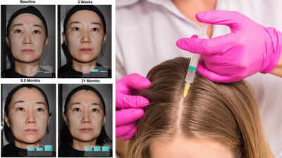 What is exosome therapy? Can it support healthier skin and hair?