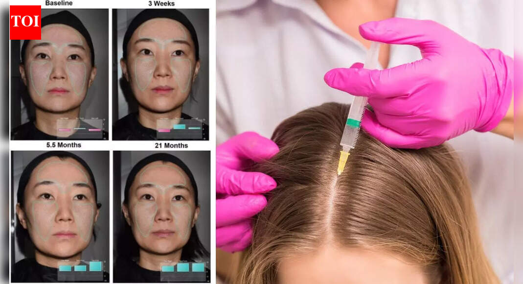 What is exosome therapy? Can it support healthier skin and hair?