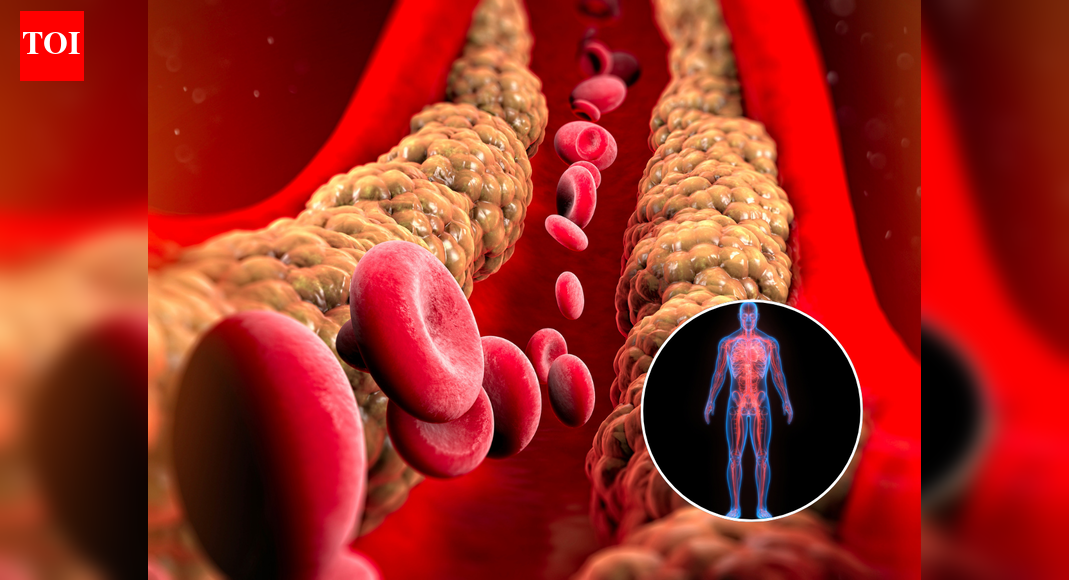 Forget diet myths: New study reveals protein that triggers cholesterol chaos, can wreck brain