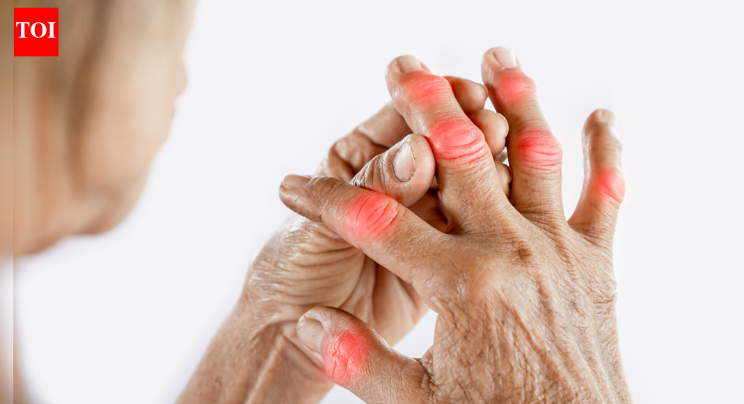 A Case Study of Arthritis and Gout Successfully Managed successfully through Ayurveda