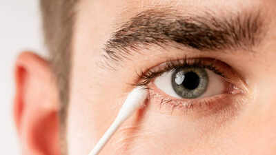 Pulling eye mucus? Top doc explains why mucus fishing is dangerous