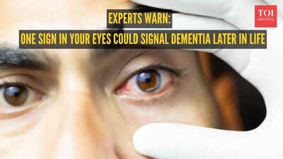 One sign in your eyes could signal dementia later in life, warn experts