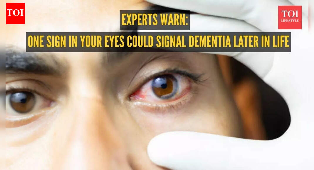 One sign in your eyes could signal dementia later in life, warn experts