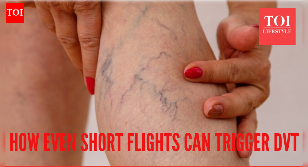 Woman lands in hospital with Deep Vein Thrombosis after a one-hour flight; Top doctor reveals why this happens