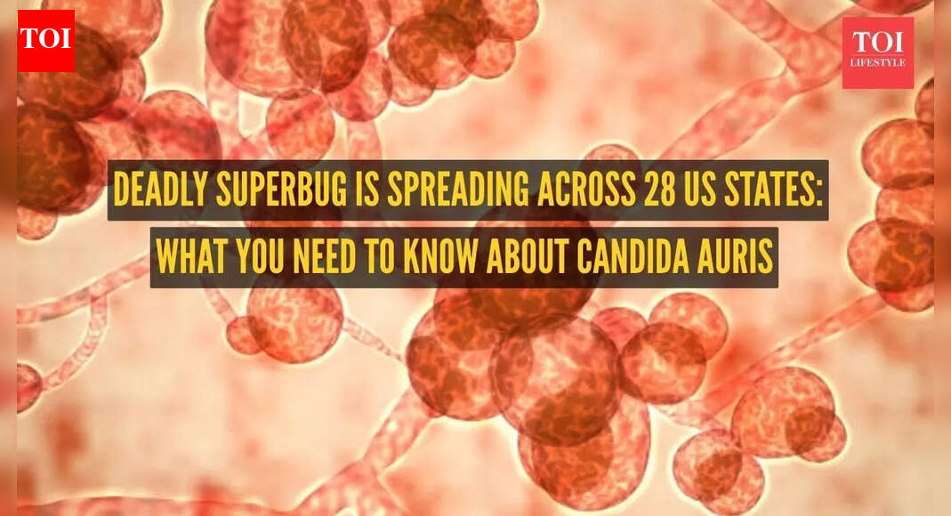 Deadly superbug is spreading across 28 US states: What you need to know about Candida auris