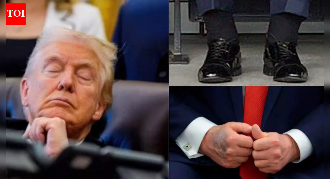 Trump says he never had an MRI, confirms high-dose aspirin behind bruises