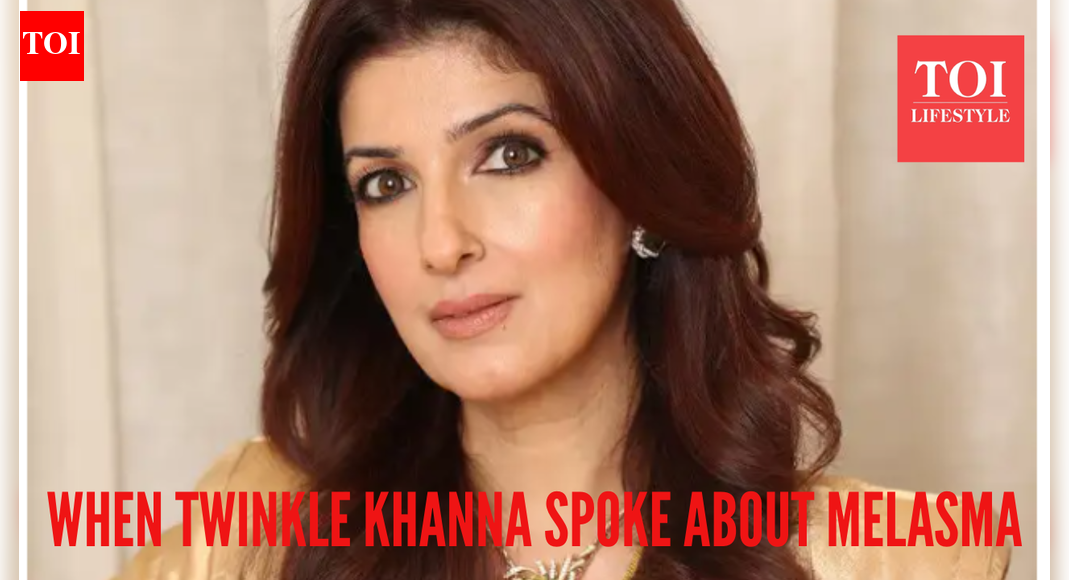 When Twinkle Khanna opened up on melasma, calling it a 'bin bulaya mehman': here's what we know on the co - Times of India