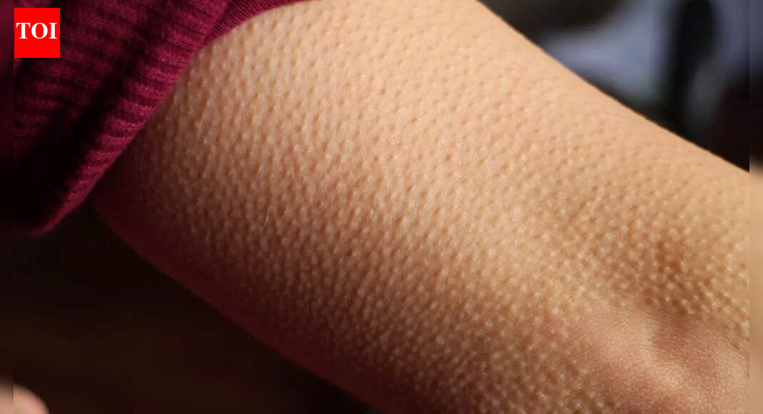 This ‘useless’ body part explains why humans get goosebumps and its surprising role in skin and hair health
