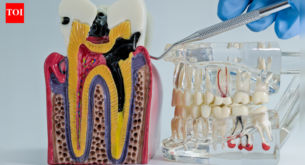 When a routine tooth extraction triggers a sight-threatening eye emergency days later