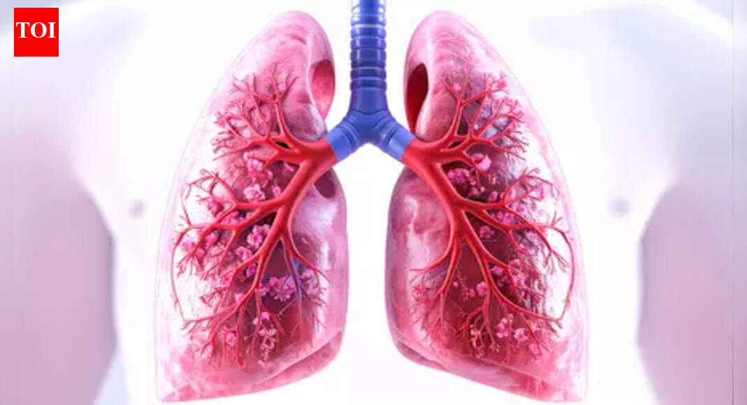 Districts with lower reporting of presumptive TB cases asked to intensify screening