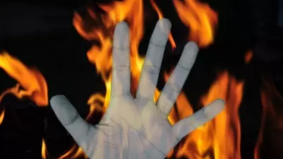 19-year-old set afire in front of college