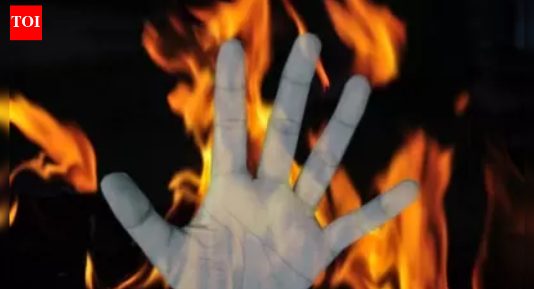 19-year-old set afire in front of college