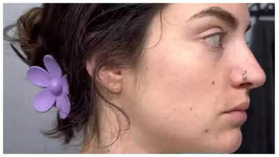 பெண் 30 நாட்களுக்கு மதுவை விட்டுவிட்டு, தன் அற்புதமான தோல் மாற்றத்தை பகிர்ந்து கொள்கிறார்; 'பழக்கத்தை முறிப்பது கடினம்....'