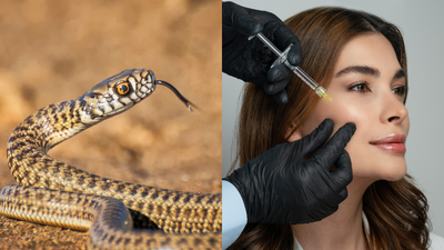  Botox could help treat snakebites