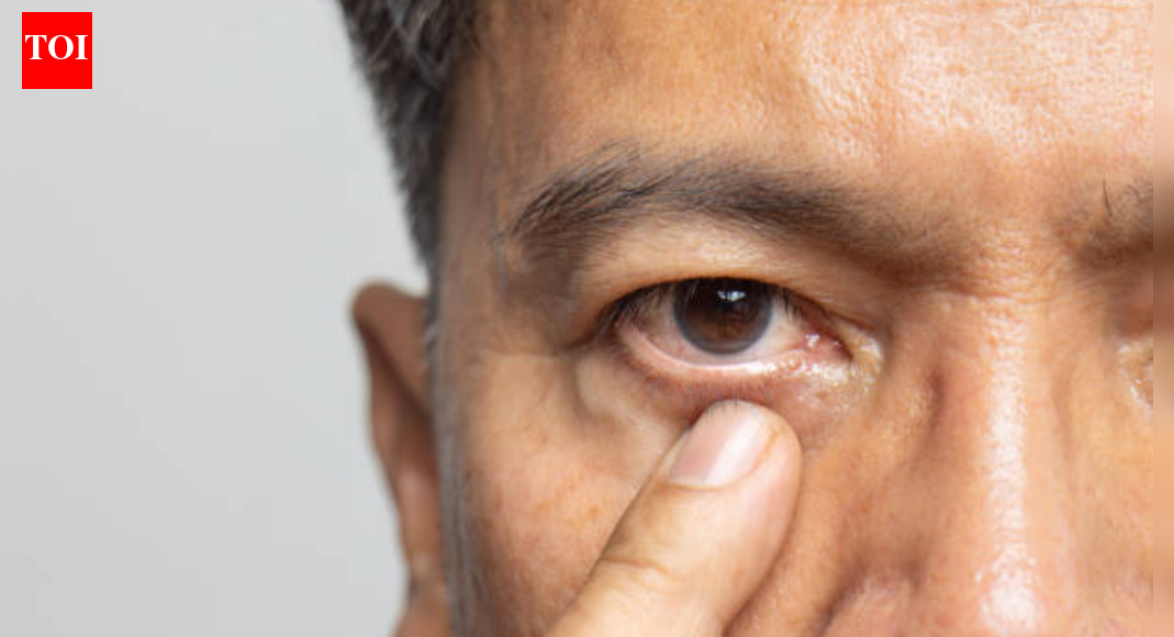 Glaucoma makes you lose vision without warning: Doctors share how it begins
