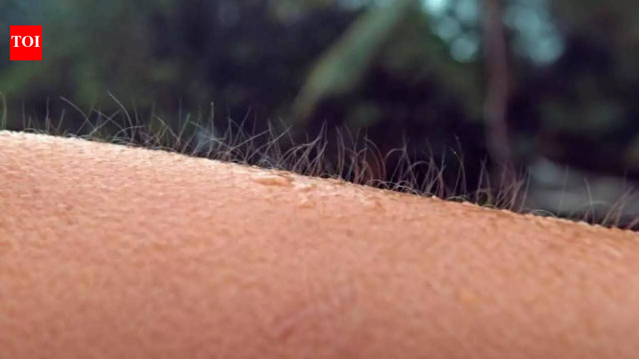 Curiosity Corner: Why do we get goosebumps?