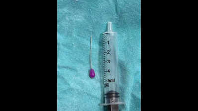 GMCH doctors remove inhaled metal pin from 18-year-old’s lower respiratory system