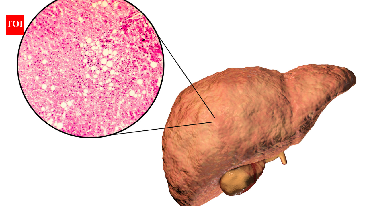 Holistic Recovery from Pre-Diabetes and Fatty Liver through yoga and Ayurveda treatment