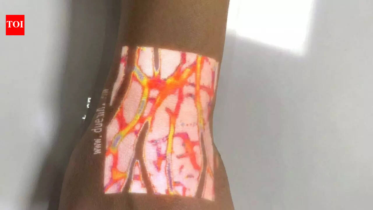 Chinese company builds a device that can ‘see through’ your skin and show your veins instantly