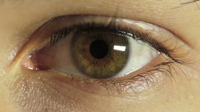 Teen worker injures eye in Pune, doctors help him regain partial vision