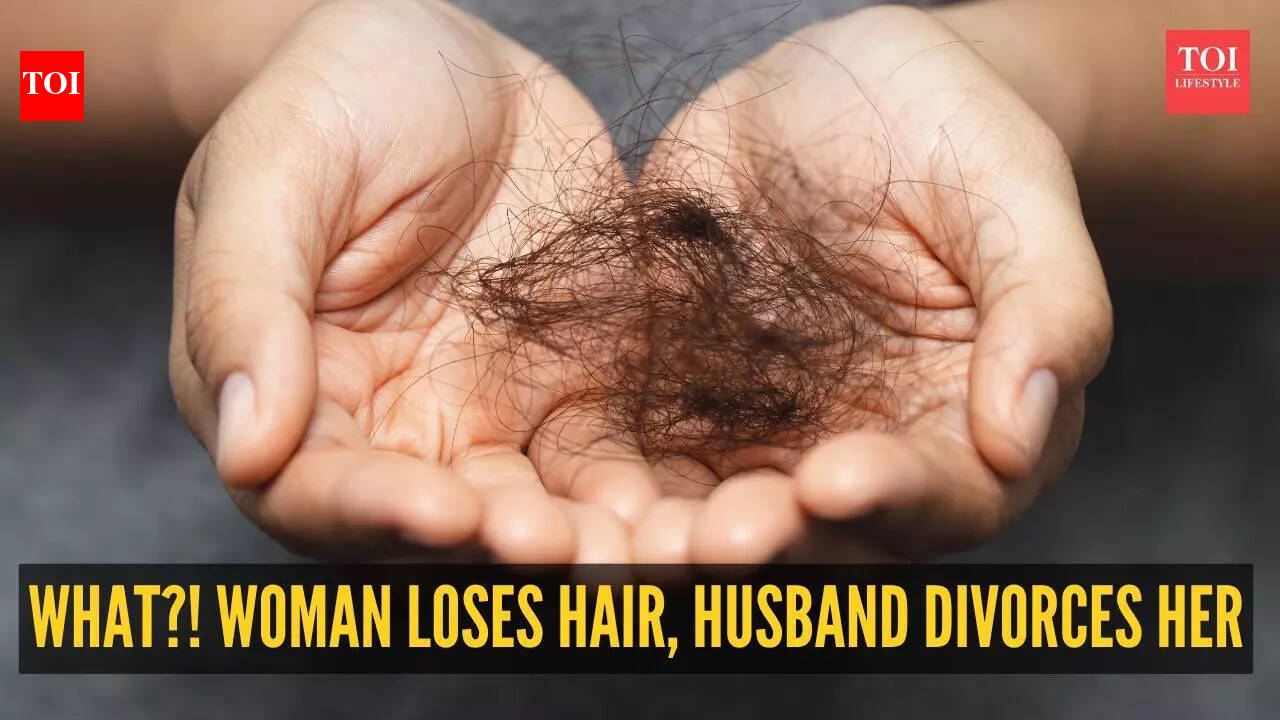 Bizarre! Husband divorces wife after she loses hair