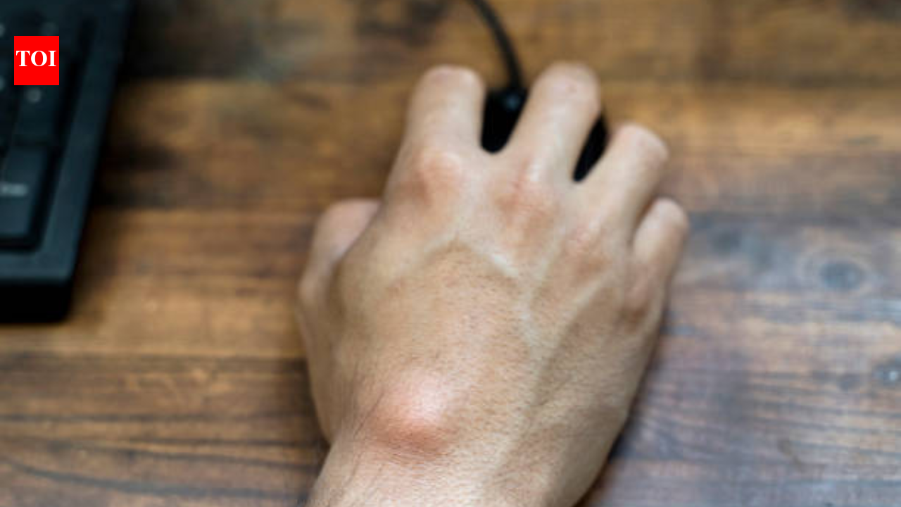 Lumps, swellings, and bumps: What’s normal and what’s not