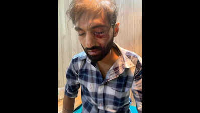Mumbai railway police arrest labourer for throwing stone at train after man loses eye