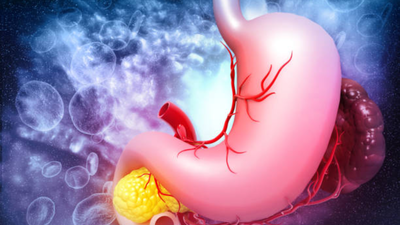 குருகிராமில் அரிதான இரைப்பை குடல் ஸ்ட்ரோமல் கட்டி, ஆபத்தான முறையில் குறைந்த இரத்த அழுத்தம் கொண்ட மனிதனுக்கு வெற்றிகரமான ரோபோ அறுவை சிகிச்சை செய்யப்பட்டது