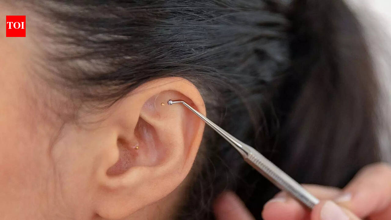 Ear Seeding: Can tiny seeds really help silence metro madness?