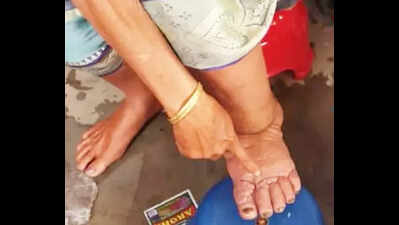 Special mass drug administration drive against filariasis kicks off in state