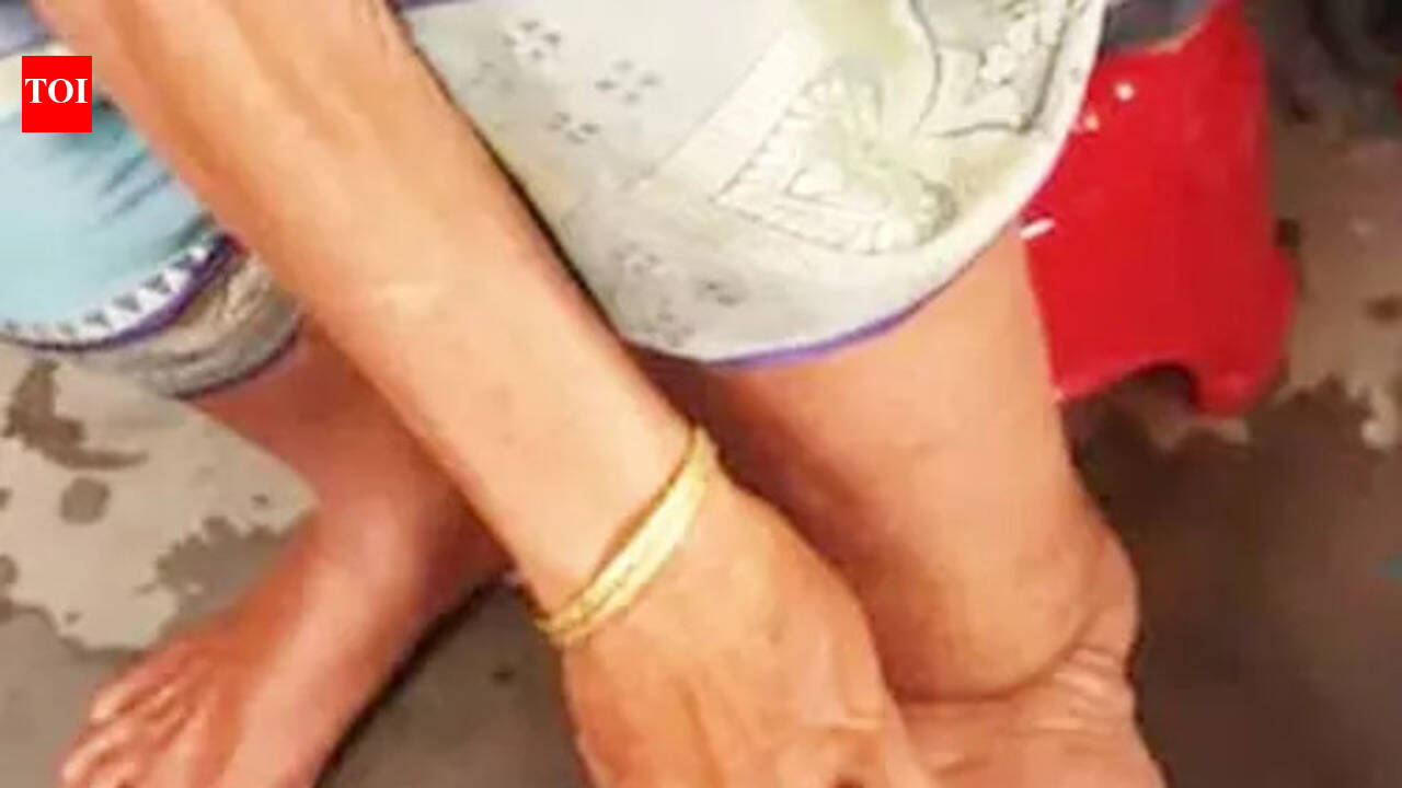 Special mass drug administration drive against filariasis kicks off in state