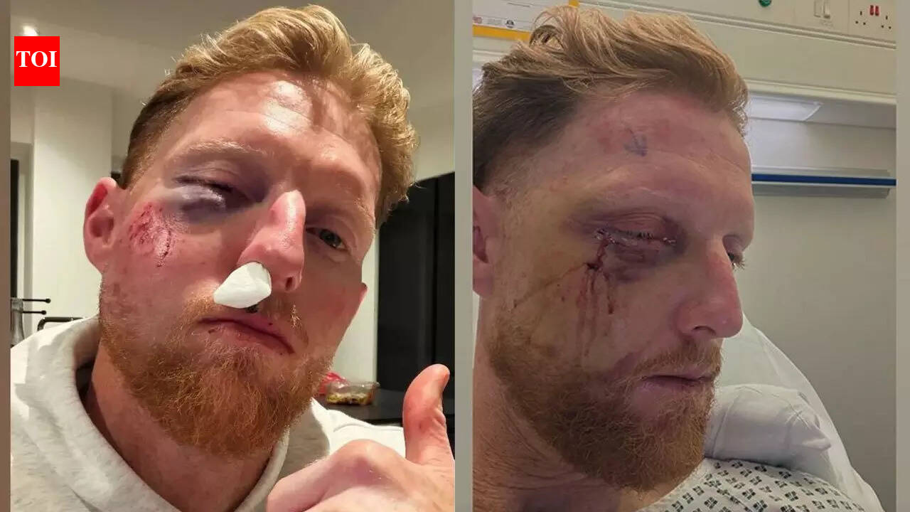 Ben Stokes undergoes facial surgery after freak blow, shares pic