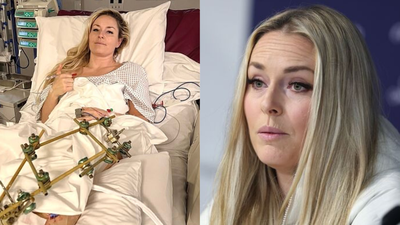 Lindsey Vonn shares emotional hospital update after third surgery as broken leg ends Winter Olympics comeback dream