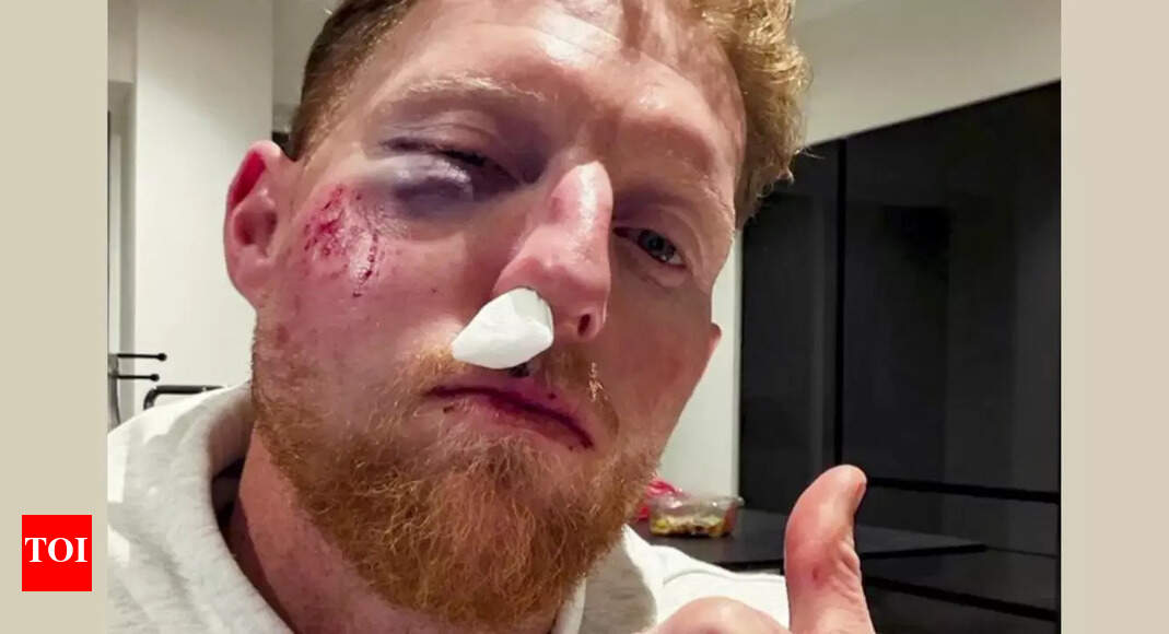 'Cricket balls do serious damage': Ben Stokes undergoes surgery; vows to 'never not wear a helmet' after injury