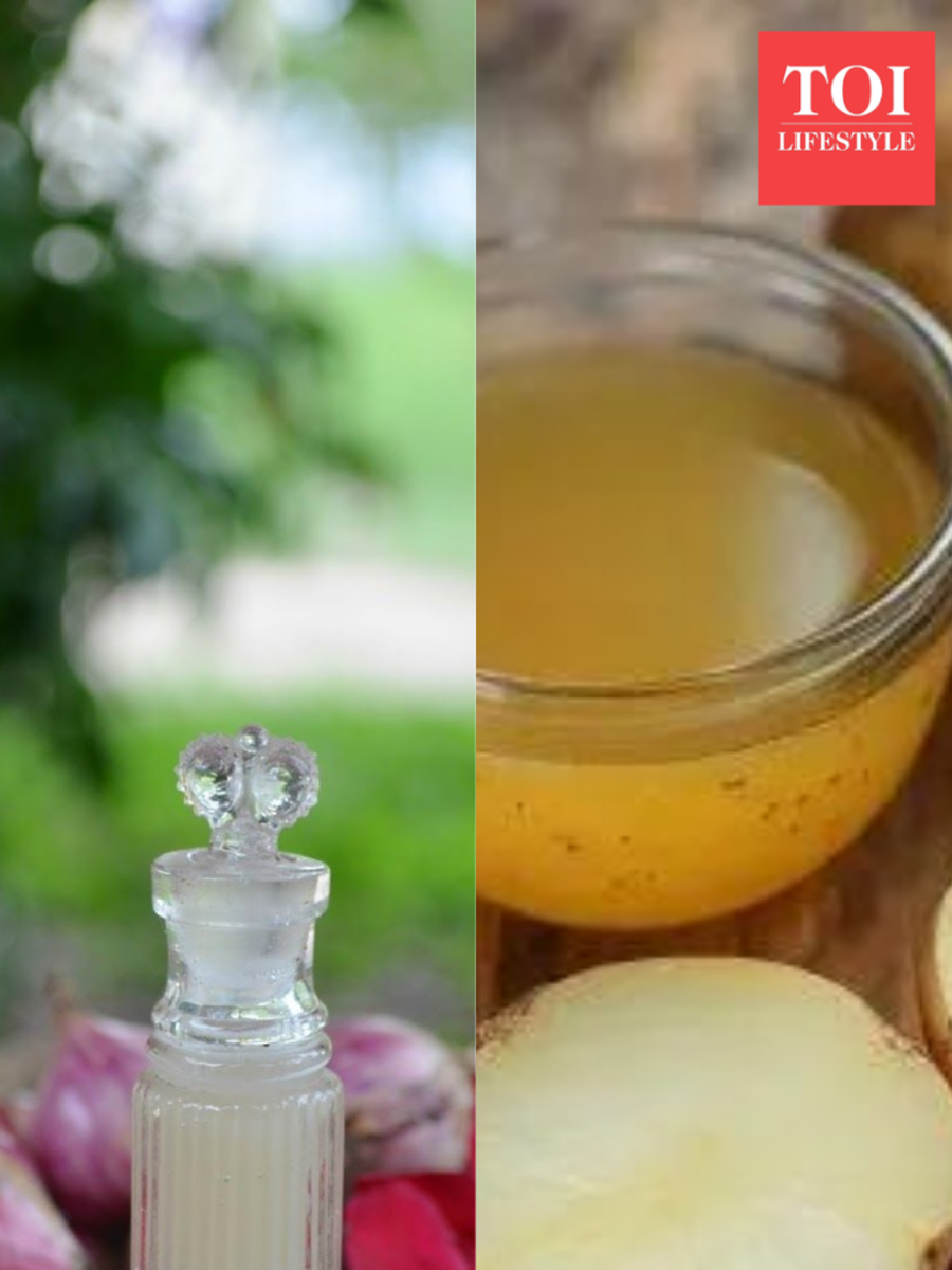 Onion juice vs potato juice for hair growth: Which home remedy works best?