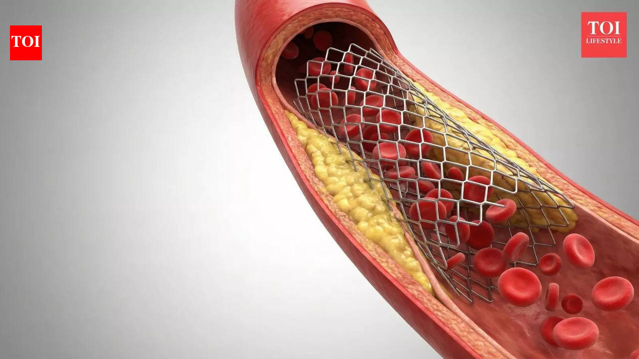 Laser angioplasty: Not the magic wand many heart patients imagine it to be